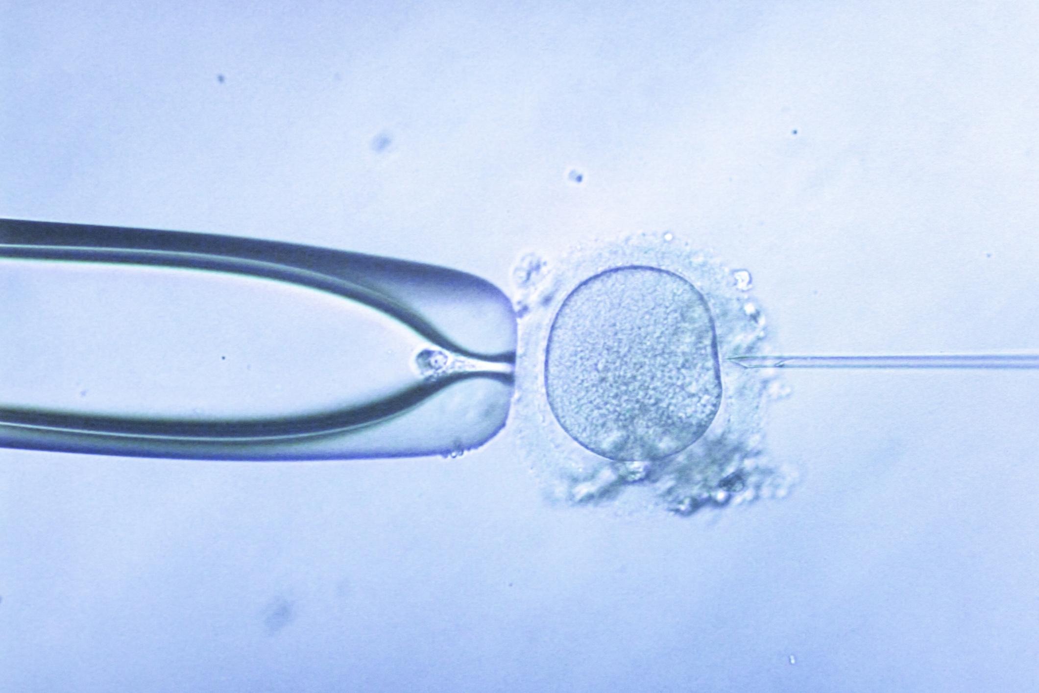 Male Fertility Evaluation